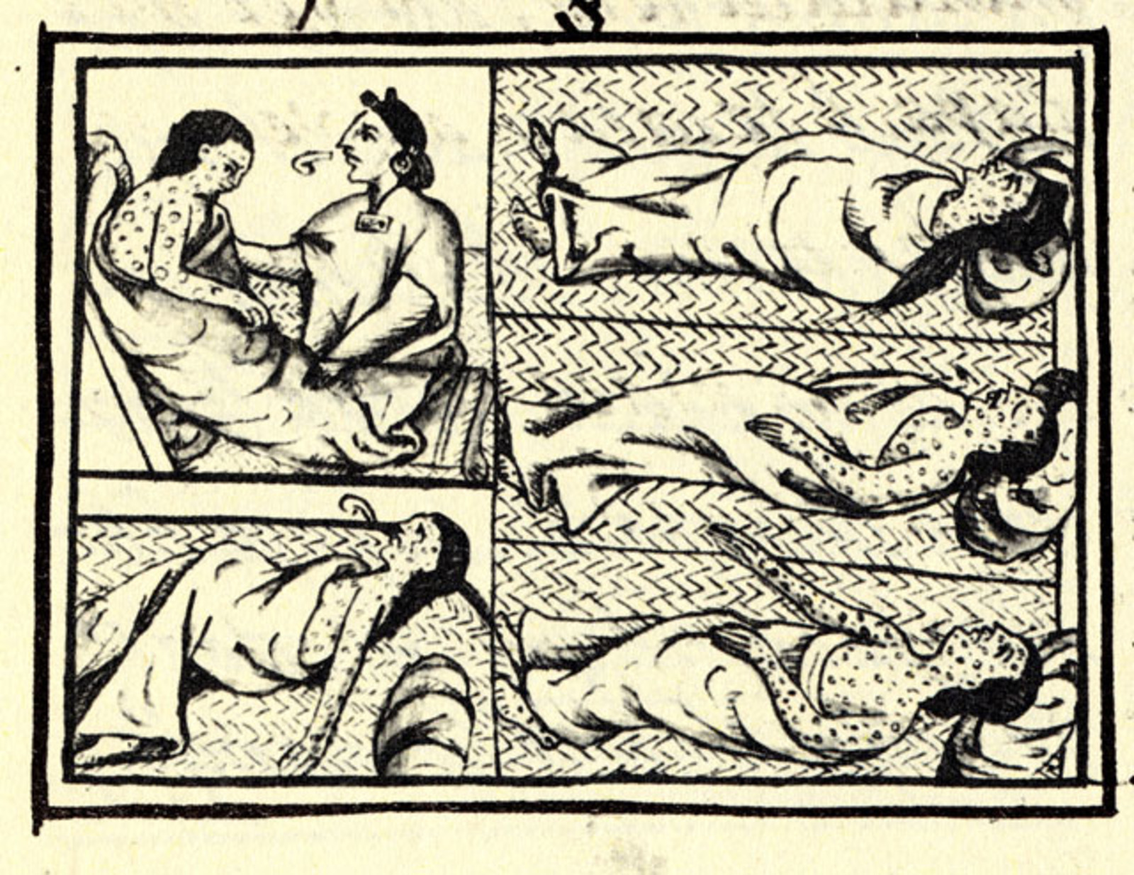 Drawing accompanying text in Book XII of the 16th-century Florentine Codex (compiled 1555–1576), showing Nahuas of conquest-era central Mexico with smallpox. Credit: Public Domain